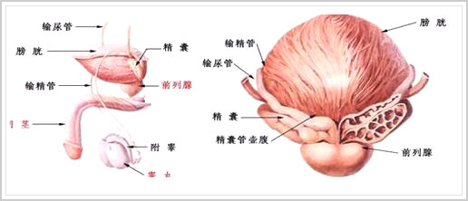 前列腺囊肿