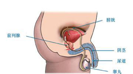 男性前列腺肥大
