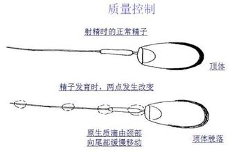 导致男性精子畸形率高的原因